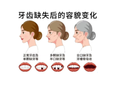 【科學(xué)科普】十個(gè)常用的口腔小知識(shí)！