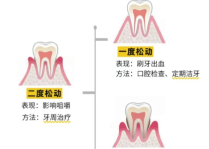 老年人牙齒松動(dòng)了要怎么辦？