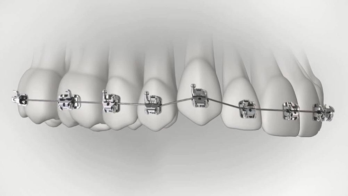 承德市哪家口腔醫(yī)院口腔正畸做得好？惟德口腔醫(yī)院來告訴您